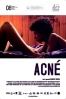 Poster de Acn� (Acn�)