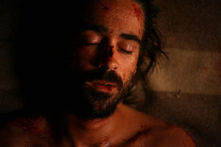 Foto de  (Triage)