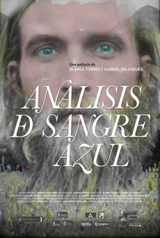 Análisis de sangre azul Imagen de Análisis de sangre azul