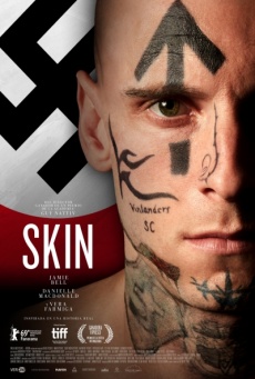 Skin Imagen de Skin